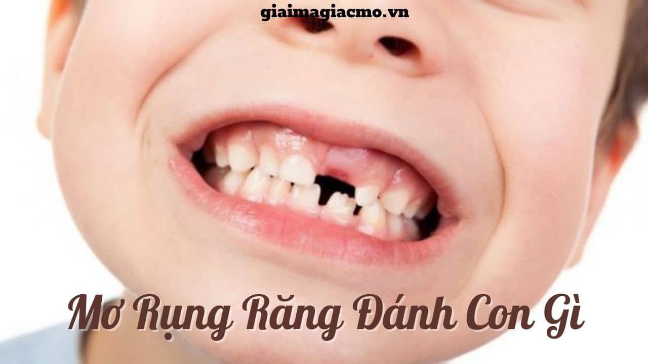 Giải mã giấc mơ rụng răng - Bí mật đằng sau giấc mơ thường gặp